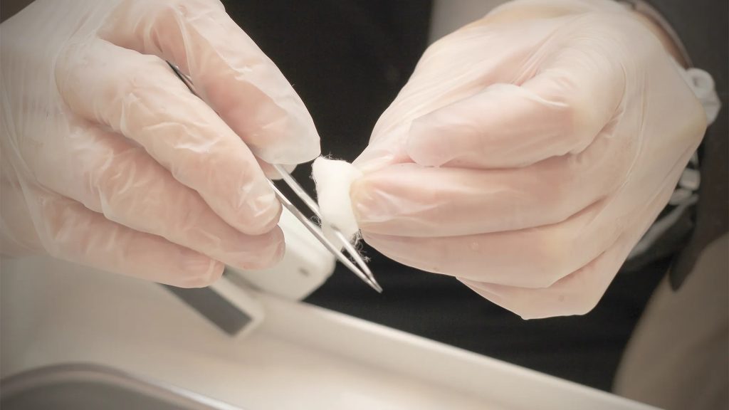 粉刺護理流程-2