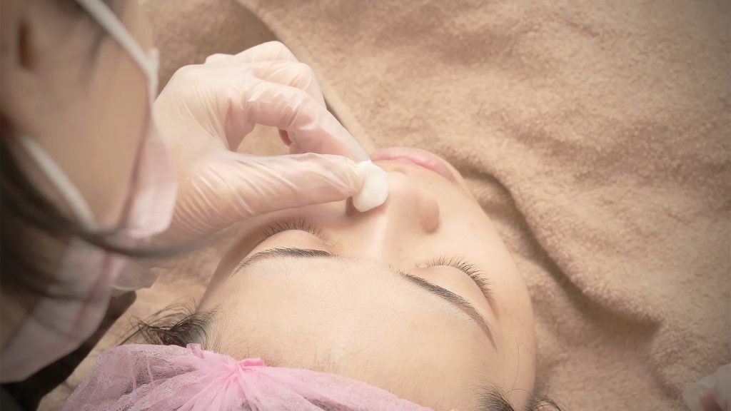 acne pimple care process 03