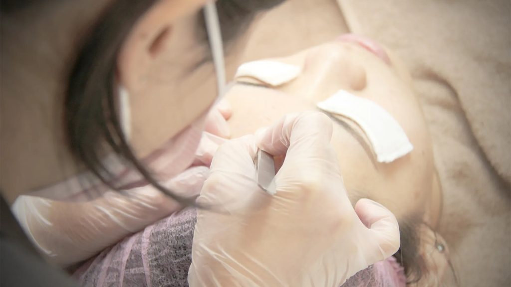 粉刺護理流程-5