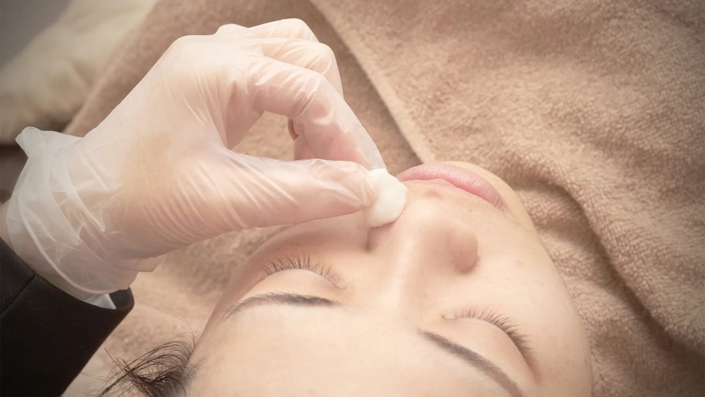 粉刺護理流程-8