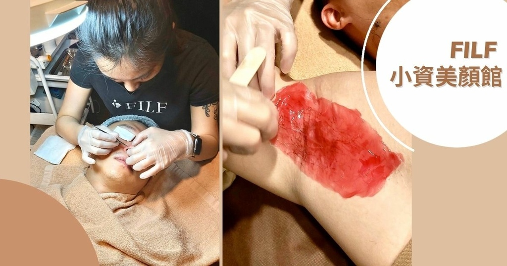 【男生美顏｜腋下除毛】顧客見證分享