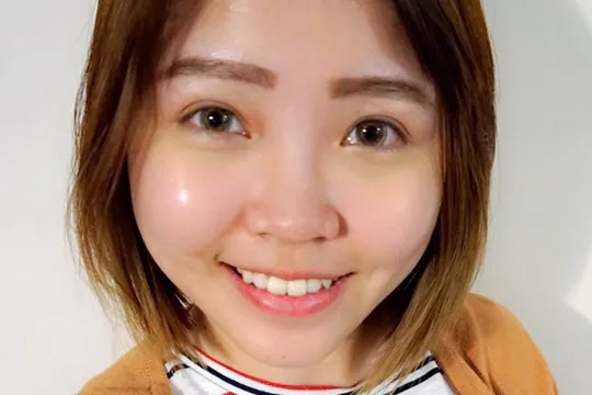 【頂級杏仁酸喚膚】顧客見證分享