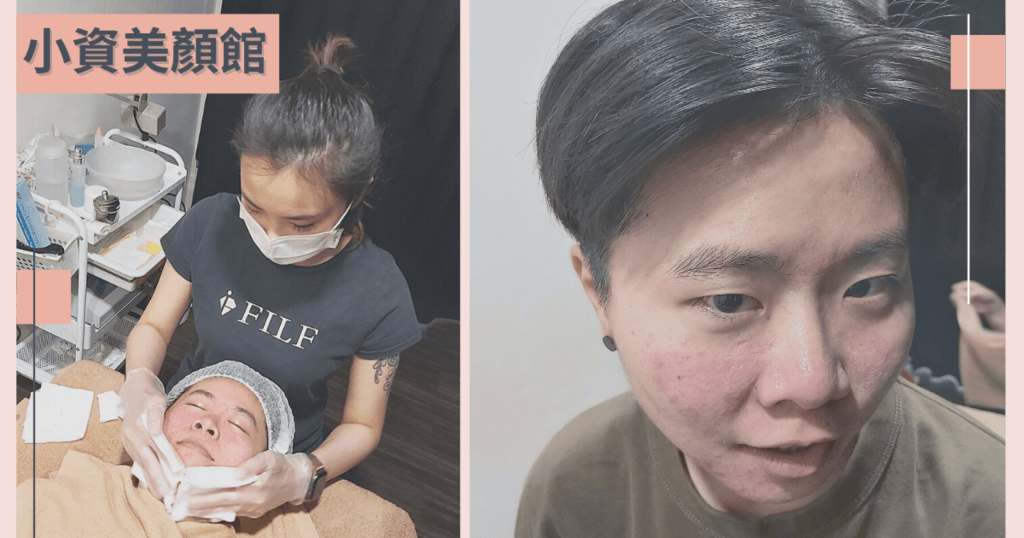 【敏感肌膚也能做臉】顧客見證分享