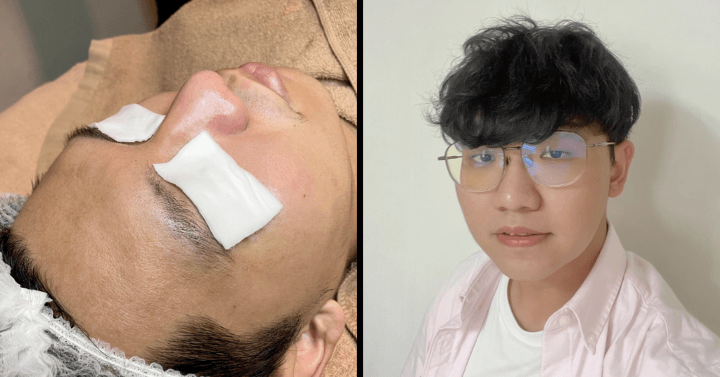 【台南清粉刺男生推薦】顧客見證分享