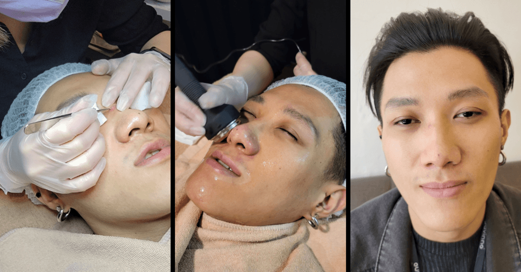 【台南男生做臉推薦！】顧客見證分享