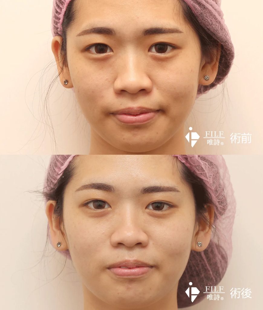 極致導入 7 極致導入流程-5