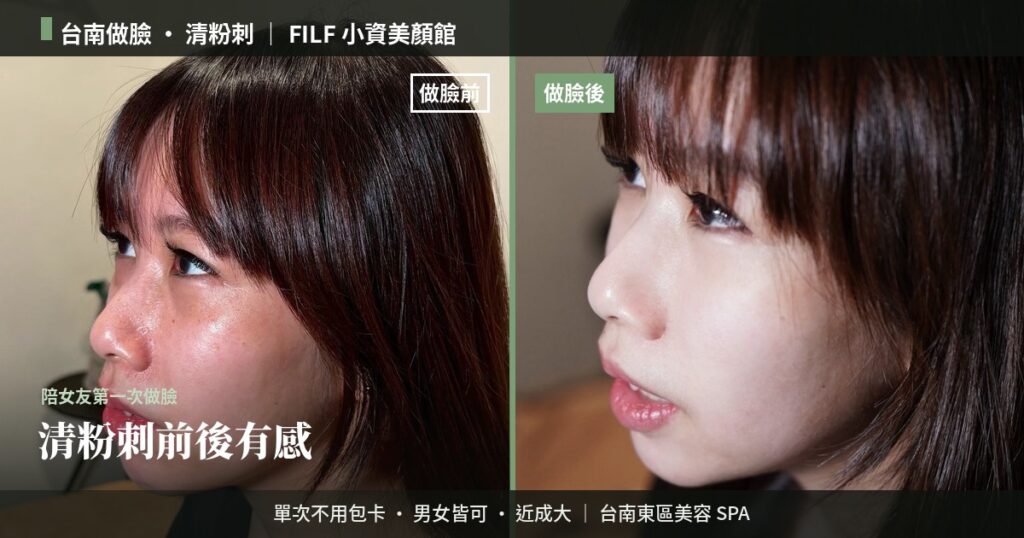 【第一次到FILF做臉】客戶體驗分享